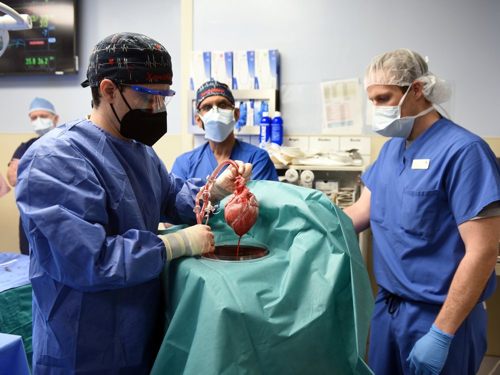 David Bennett Becomes First man ever to Receive a Heart from a Gene Edited Pig